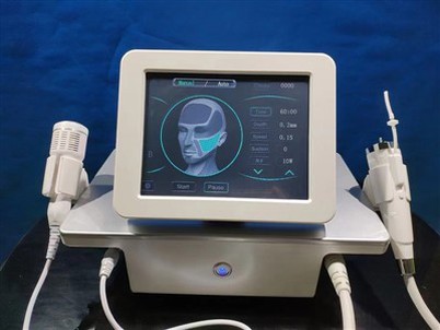 مائکروونیڈل فریکشنل آر ایف مشین